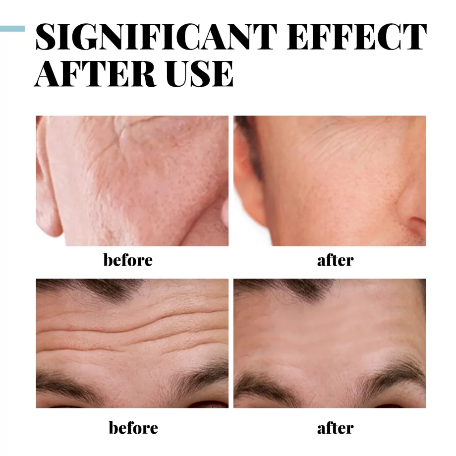 Eelhoe-Collagen Anti Wrinkle Creams For Men Man 50g Hyaluronic Acid