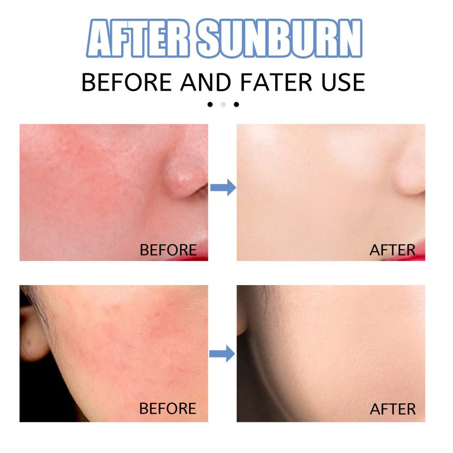 Blackening and after sun repair by Eelhoe